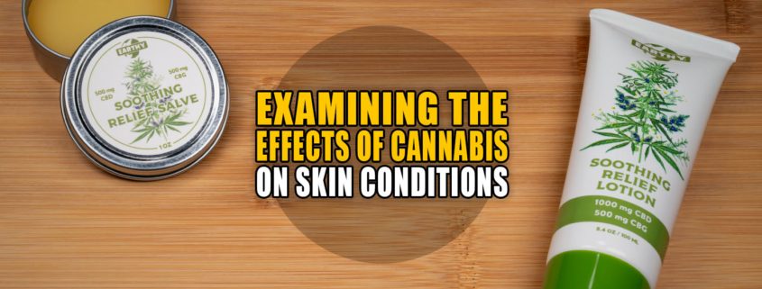 Examining the Effects of Cannabis on Skin Conditions | Earthy Now